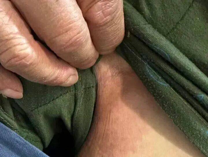 皇冠信用需要押金吗_68岁大伯被蚂蚁围攻送进抢救室！短短十几秒爬满全身皇冠信用需要押金吗，罪魁祸首竟是院子里的“宝贝”